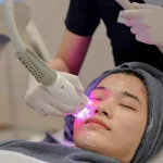 Perawatan Wajah Menggunakan Metode Laser Kecantikan