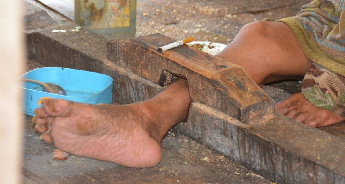 Penahanan Orang Atau Pemasungan Agar Tidak Lari