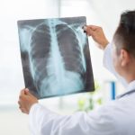 Sebuah Perlengkapan Xray Sebagai Peralatan Pembedahan