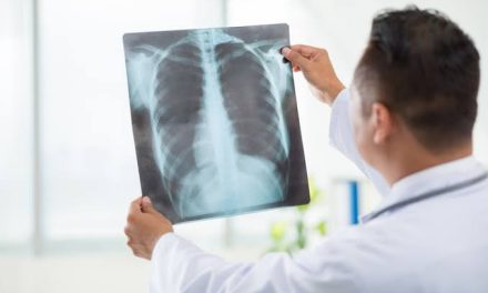 Sebuah Perlengkapan Xray Sebagai Peralatan Pembedahan