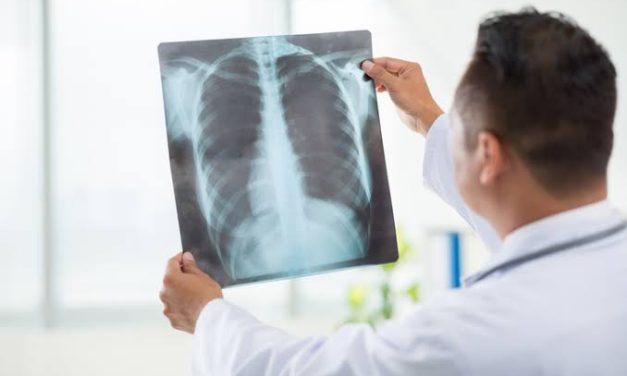 Sebuah Perlengkapan Xray Sebagai Peralatan Pembedahan