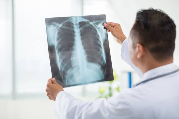 Sebuah Perlengkapan Xray Sebagai Peralatan Pembedahan